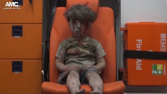 Little boy in Aleppo a vivid reminder of war`s horror - VIDEO
